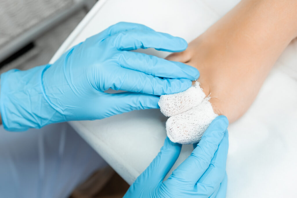 pedicure curativo, podologo vs estetista