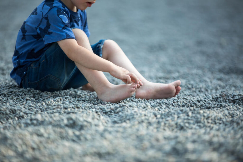 I Bambini che si strappano le unghie rappresentando un comportamento comune nei più piccoli.