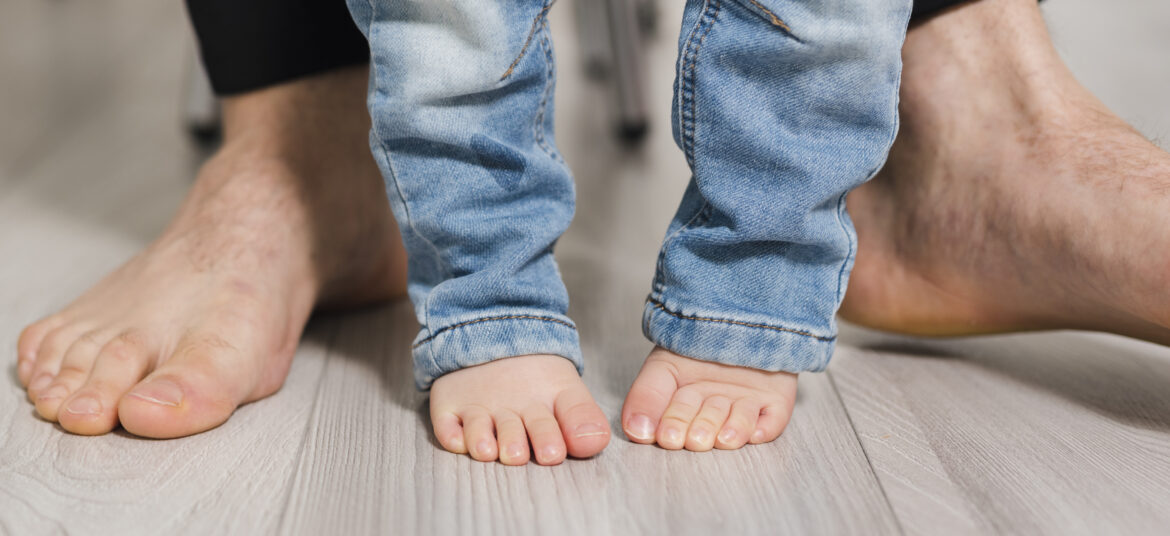 Un bambino in piedi con le punte dei piedi rivolte verso l’interno, segno di andatura intraruotata. Bambini e piedi con le punte in dentro .